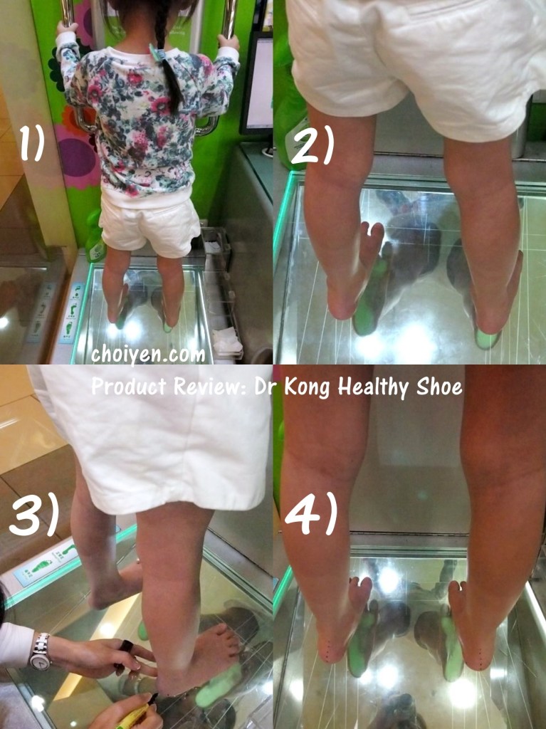 dr kong arch support